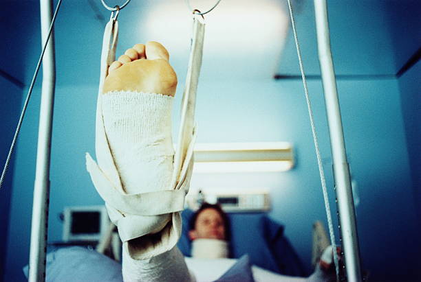 Medical Negligence Broken Leg Cases