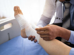 Broken ankle personal injury claim broken leg patient on the bed ,Doctor or physiotherapist giving the expert treatment to the broken leg patient on the bed for a good recovery,Patient with knee problem at consulting room