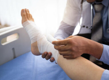 Broken ankle personal injury claim broken leg patient on the bed ,Doctor or physiotherapist giving the expert treatment to the broken leg patient on the bed for a good recovery,Patient with knee problem at consulting room